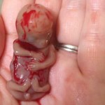 Majka podijelila sliku svoje mrtvorođene bebe