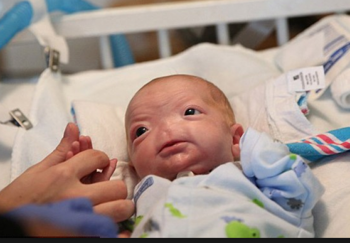 Liječnici savjetovali majci da pobaci bebu bez nosa