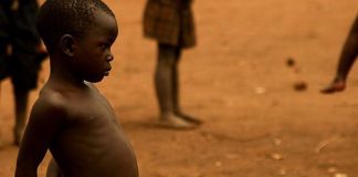 Zašto gladna djeca u Africi imaju napuhani trbuh?
