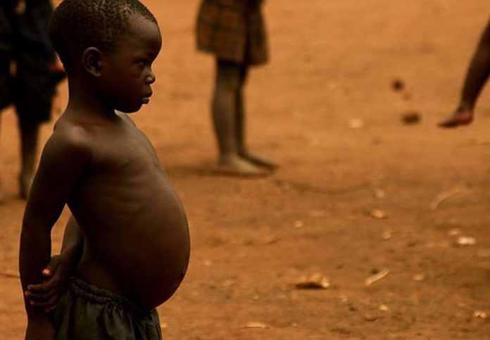 Zašto gladna djeca u Africi imaju napuhani trbuh?