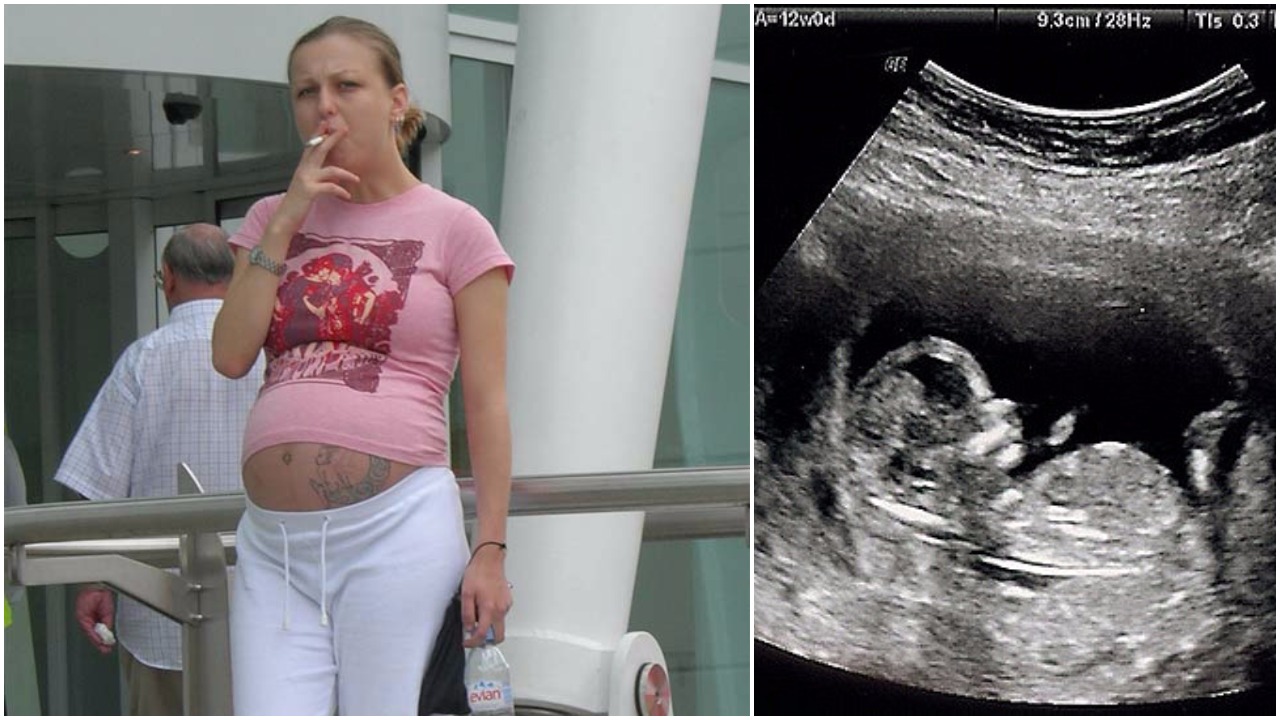 trudnice koje puše
