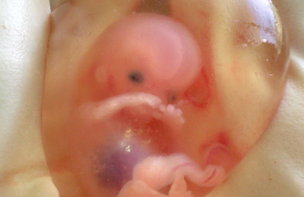 abortirani fetusi