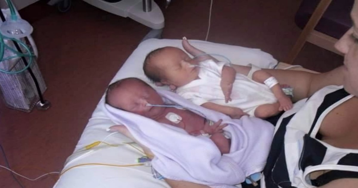 Par koji je očekivao blizance se šokirao kada im je doktor rekao: „Žao mi je“