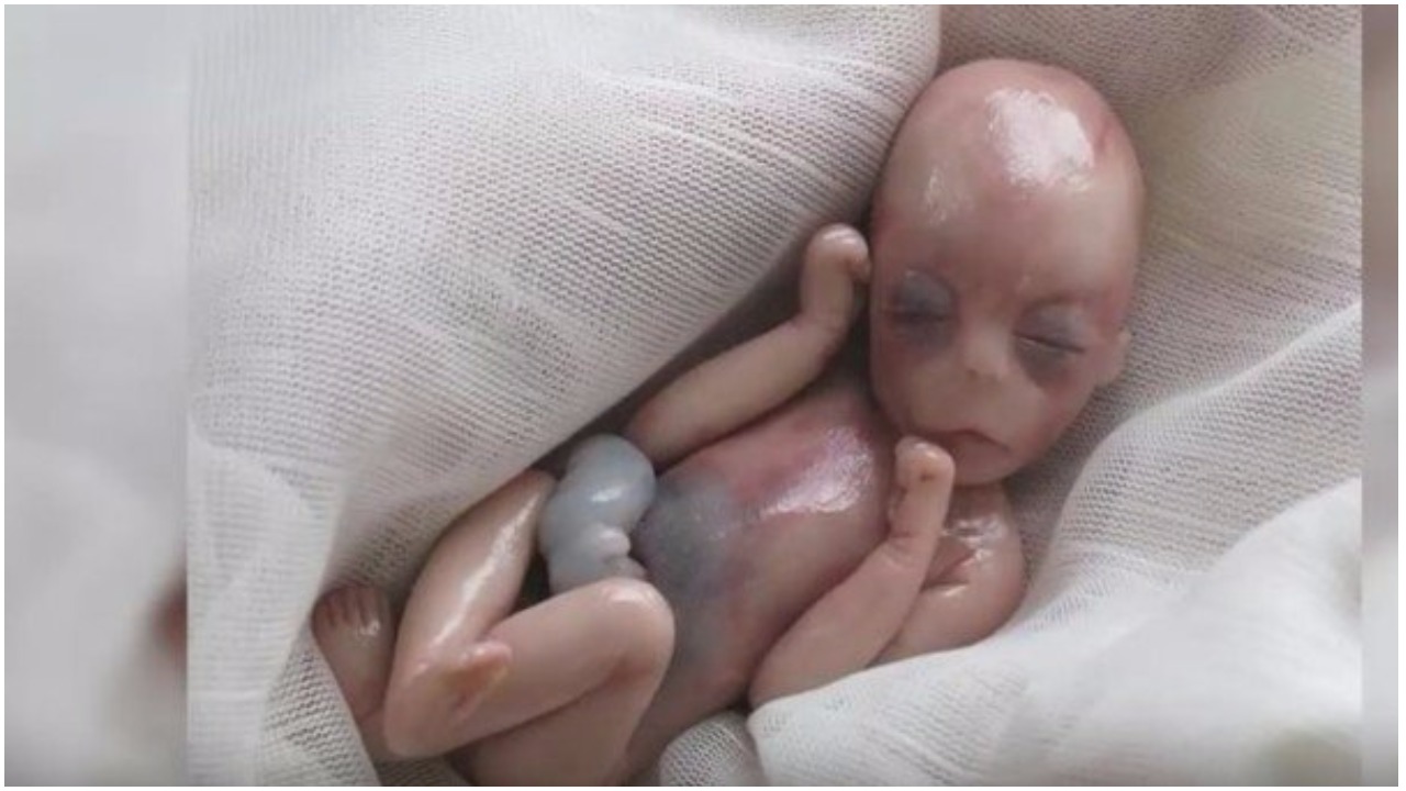 beba rođena mrtva čudo