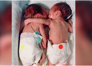 Stavila umiruću bebu pored sestre