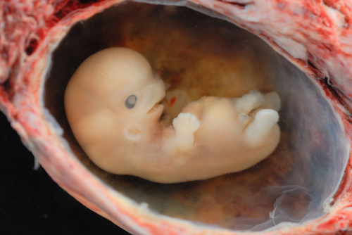 Embrij star 6 do 7 tjedana; Foto: Flickr