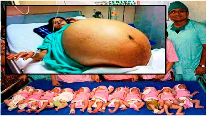 Žena rodila 11 zdravih beba bez carskog reza