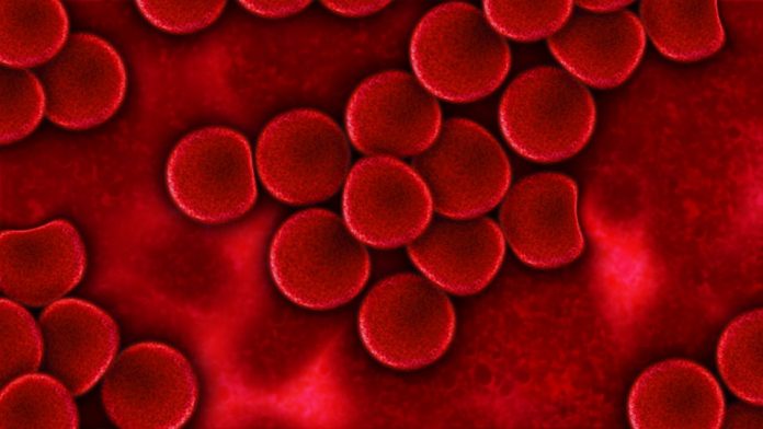 najčešći simptomi leukemije najčešći simptomi leukemije