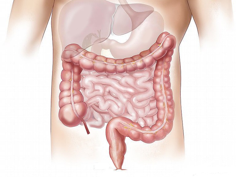 rak debelog crijeva