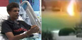 13-godišnjak kojeg je udarila munja zahvaljuje Bogu što ga je spasio