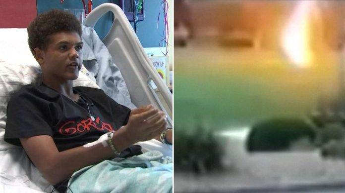 13-godišnjak kojeg je udarila munja zahvaljuje Bogu što ga je spasio