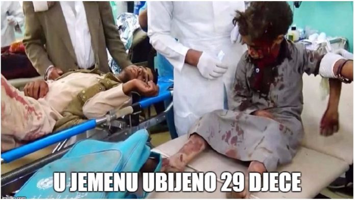 29 djece poginulo u napadu u Jemenu 29 djece poginulo u napadu u Jemenu