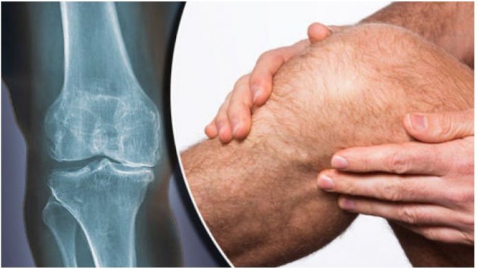 Bol u koljenu ( najčešćih bolnih stanja koljena) - Body Balance