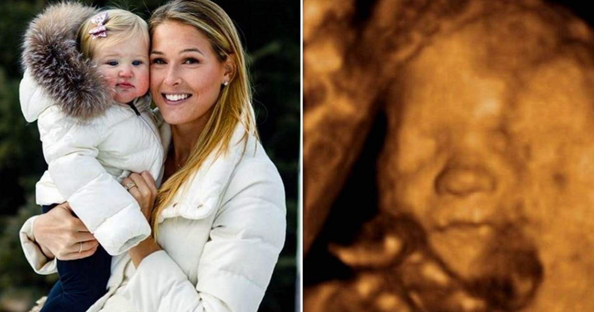 Nakon što je izgubila 19-mjesećnu kćer, žena Bode Millera se skamenila na ultrazvuku
