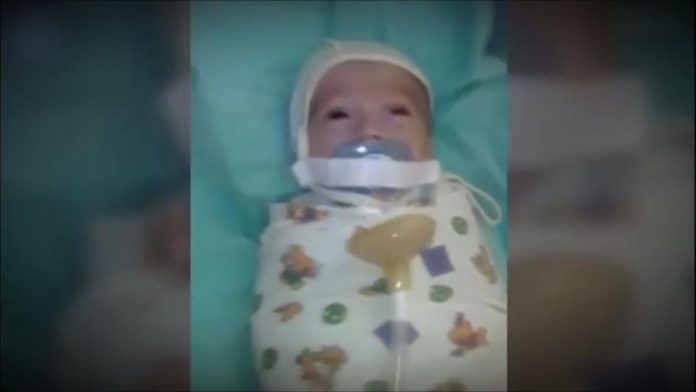 beba bolnica U ruskoj bolnici bebi zalijepili traku na usta da ne plače