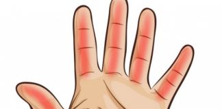 dlanovi ruke otkrivaju bolesti