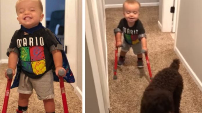 spina bifida dječak Dječak sa spinom bifidom prvi je put prohodao