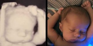 Majka se začudila kada je usporedila sliku s ultrazvuka i svoju novorođenu bebu