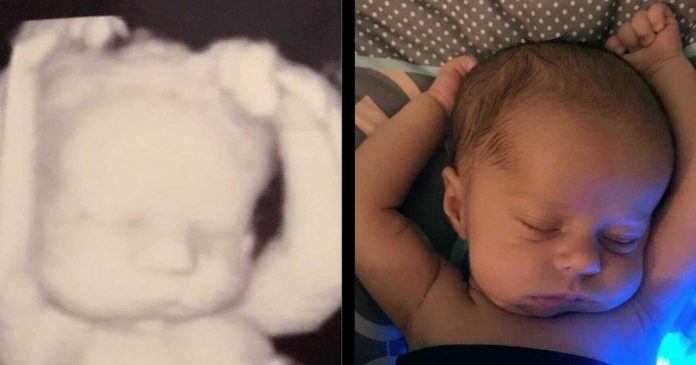 Majka se začudila kada je usporedila sliku s ultrazvuka i svoju novorođenu bebu