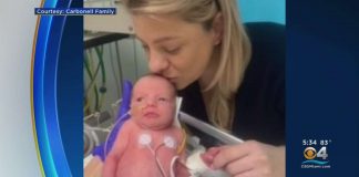Doktori zadržali bebu u majci tjednima nakon što joj je pukao vodenjak