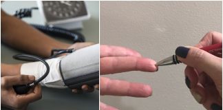 Jednostavan trik za snižavanje krvnog tlaka s kemijskom olovkom