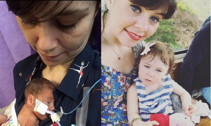 Edie Madoc-Jones Ova beba je rođena s brojnim problemima, a njezin oporavak je zadivio liječnike