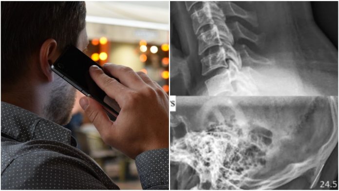 Mobitel mijenja oblik lubanje Mobitel mijenja oblik lubanje