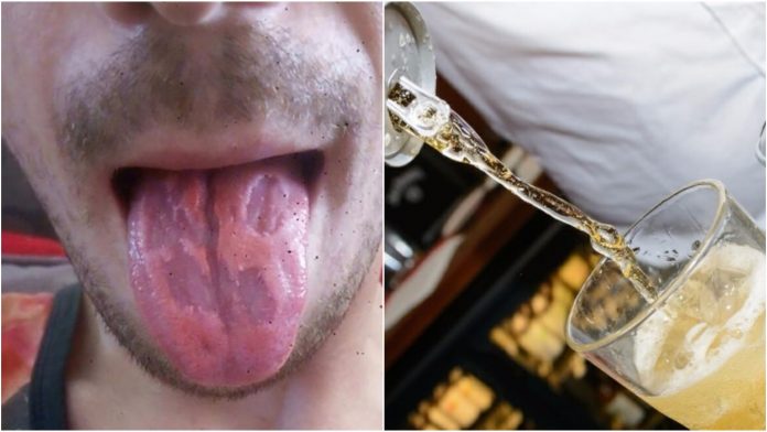 Objavio je šokantnu fotografiju svog jezika kako bi upozorio na opasno piće