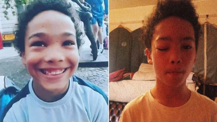Dječak (9) preminuo četiri dana nakon ''ugriza insekta''