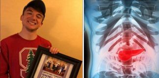 Dječak (15) izumio test za rak gušterače koji daje 100% točne rezultate