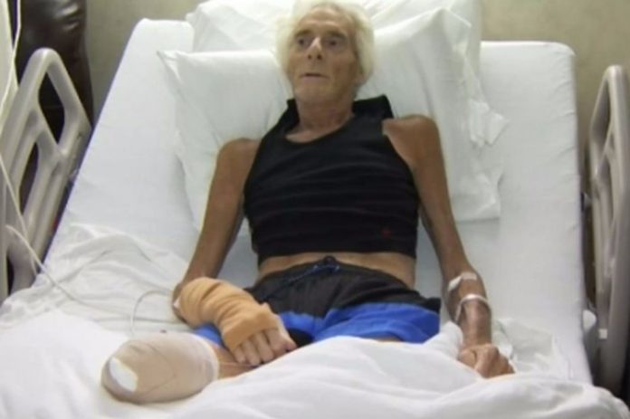 posjekotina bakterija Zbog male posjekotine su mu morali amputirati nogu