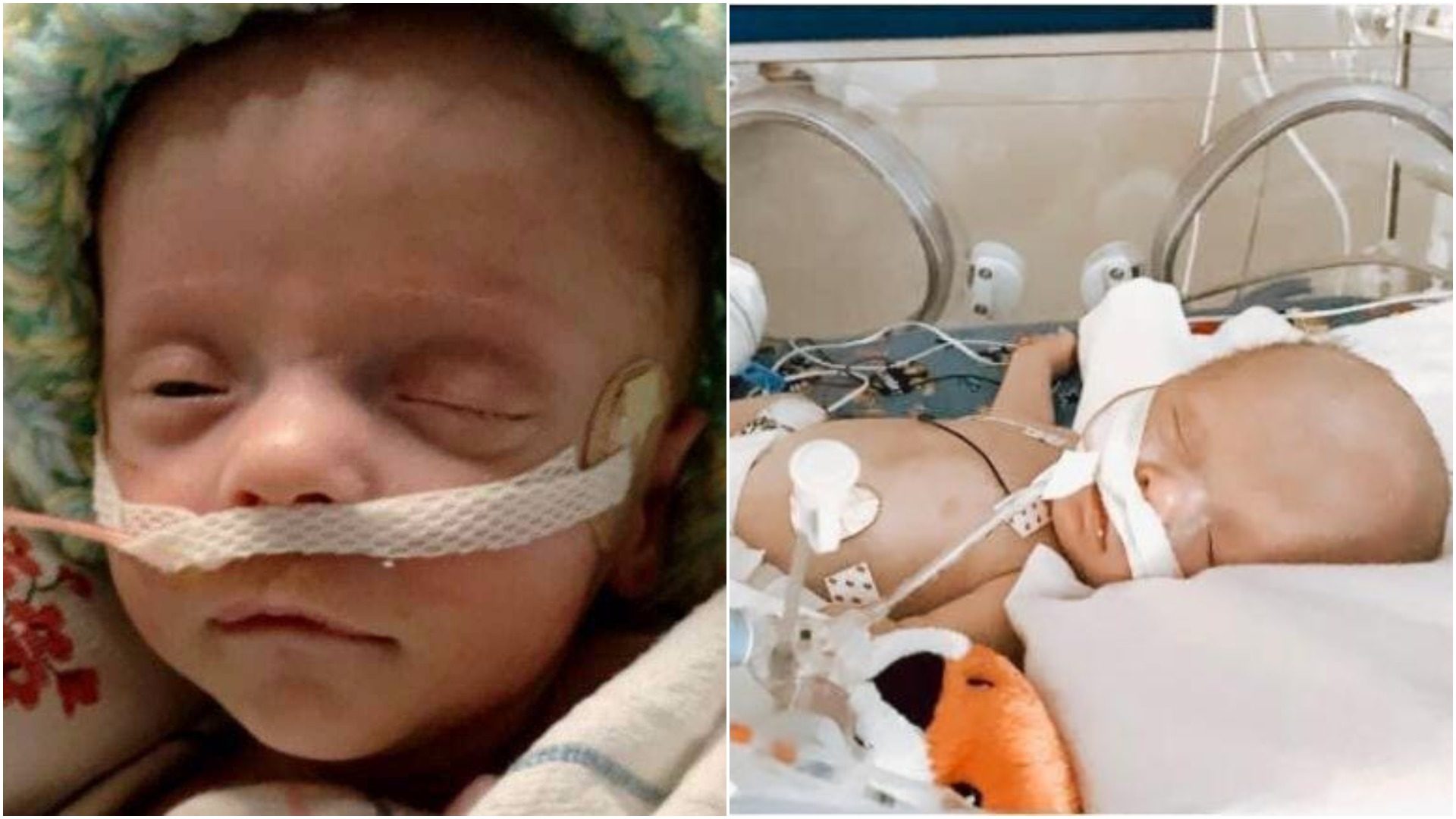 Beba se bori i nakon što su liječnici isključili aparat