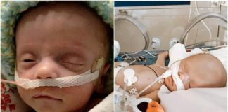 Beba se bori i nakon što su liječnici isključili aparat