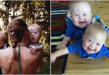 Mama je htjela dati na posvajanje blizance s Downovim sindromom, no nešto ju je natjeralo da se predomisli