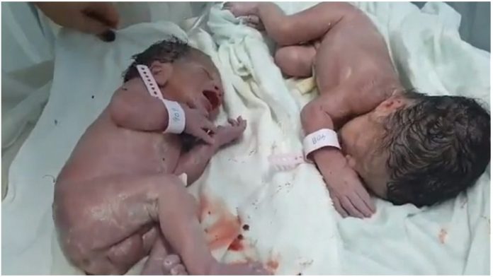 Čudo života u Albaniji: Svi dijele video blizanaca rođenih 20 minuta nakon potresa