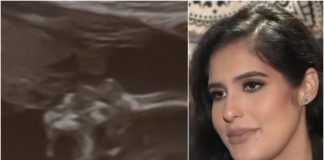 Dok je gledala sliku s ultrazvuka, uočila je da netko ljubi njenu bebu