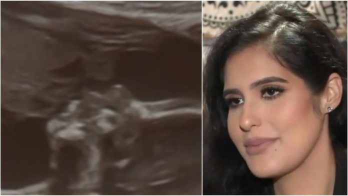 Dok je gledala sliku s ultrazvuka, uočila je da netko ljubi njenu bebu Dok je gledala sliku s ultrazvuka, uočila je da netko ljubi njenu bebu