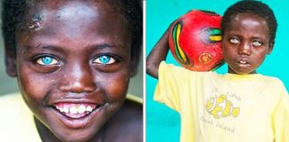 Dječak iz Etiopije će vas zadiviti svojim predivnim plavim očima