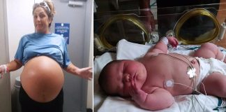 Liječnici su se počeli smijati kada su vidjeli njenu bebu