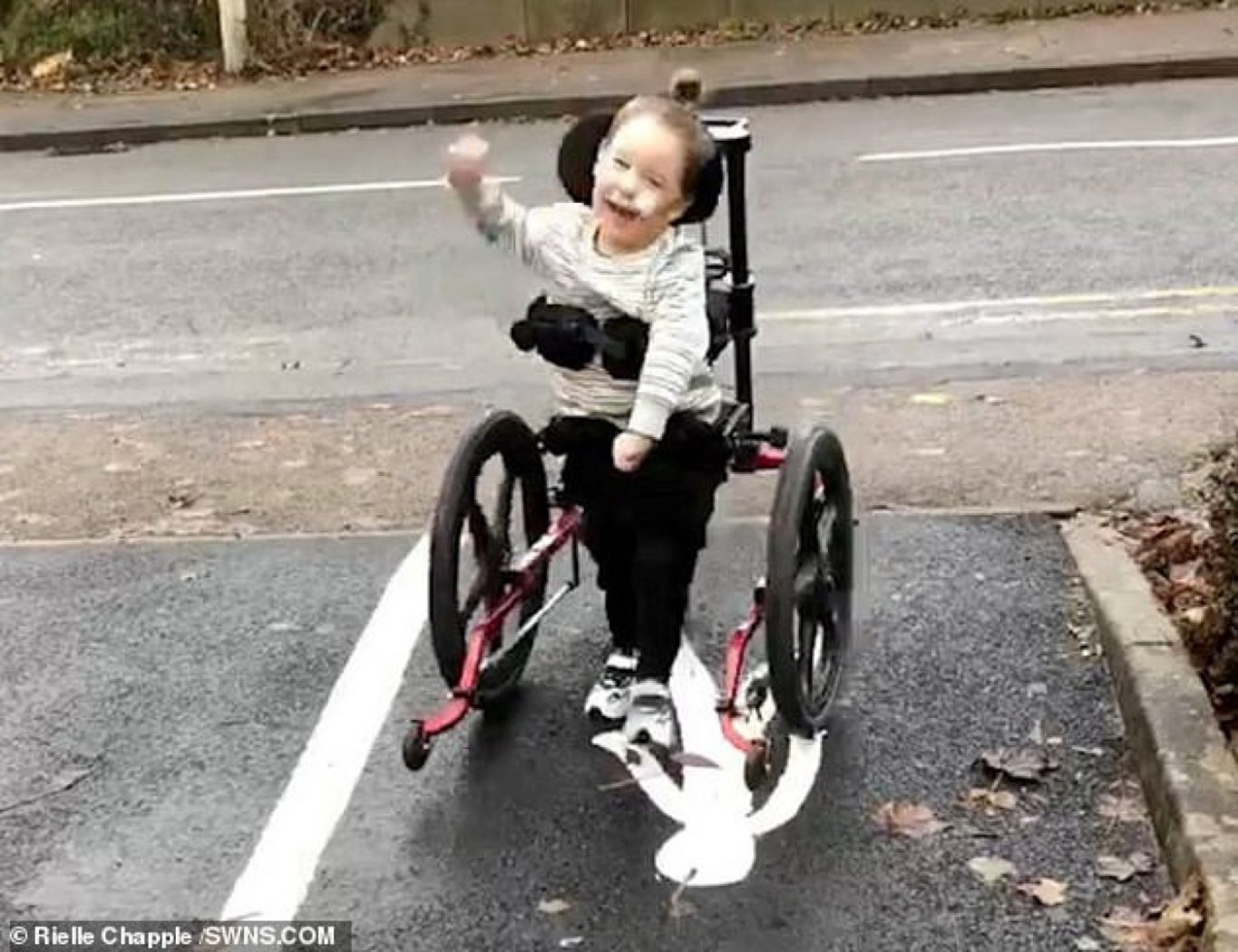 Dječak s cerebralnom paralizom prohodao