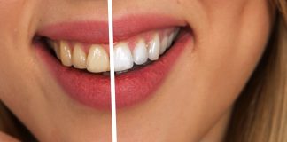 Prirodne metode za izbjeljivanje zubi