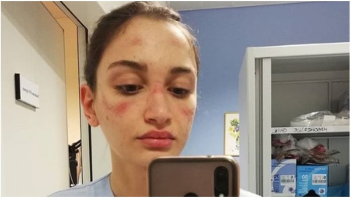 Medicinska sestra iz Milana je objavila selfie s važnom porukom Medicinska sestra iz Milana je objavila selfie s važnom porukom