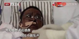Dvojica Kineza nakon koronavirusa postala potpuno crna
