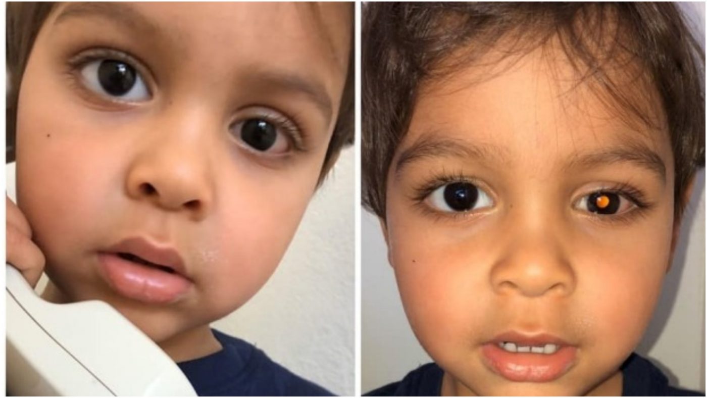 Mrlja u dječakovom oku je otkrila šokantnu dijagnozu