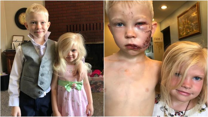 Dječak (6) spasio sestru od napada psa
