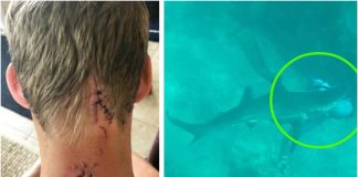 Preživio je napad morskog psa