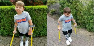 Dječak bez nogu prehodao 10 kilometara kako bi skupio novac za bolnicu