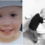 Kako izgleda leukemija u djetinjstvu?