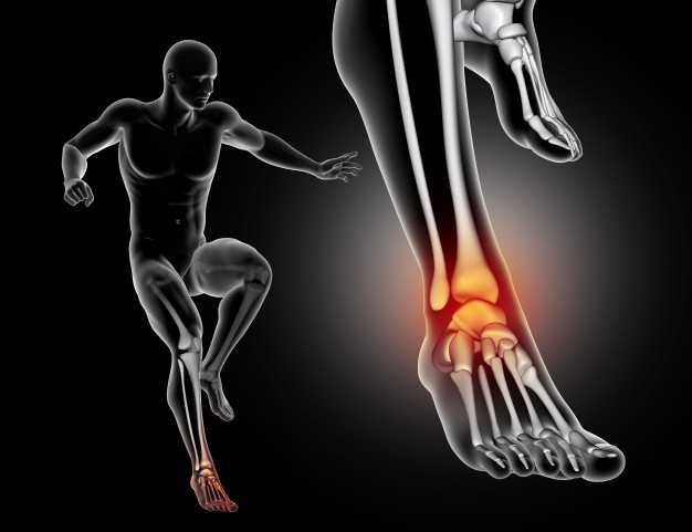 artroza o njezi stopala zajednički kralježnice bol