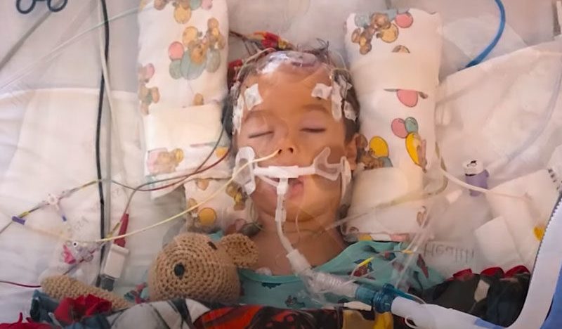 Osmogodišnjak čudesno preživio nakon teške ozljede mozga